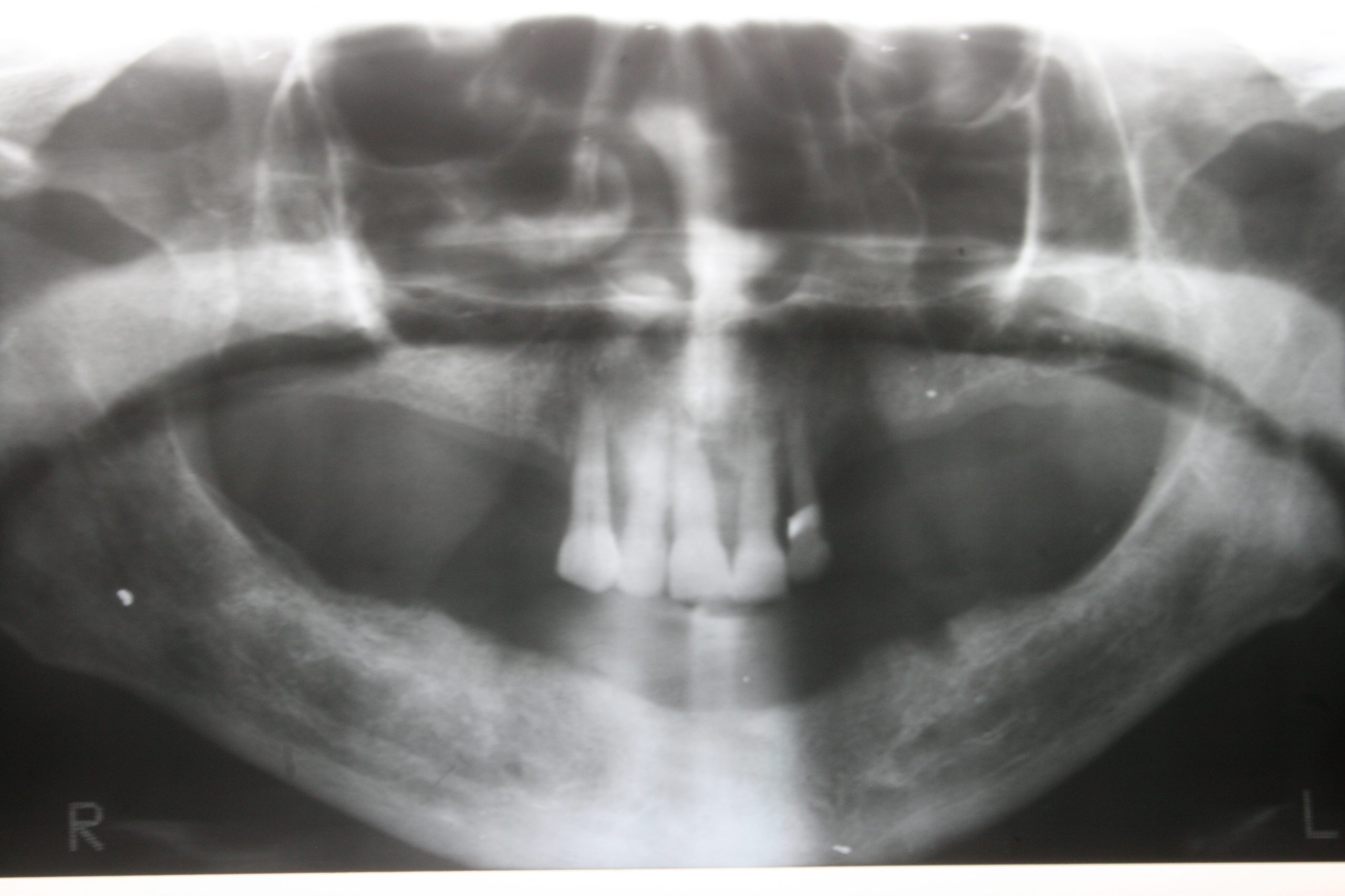 DC-Inferior-1-Ortopantomografia